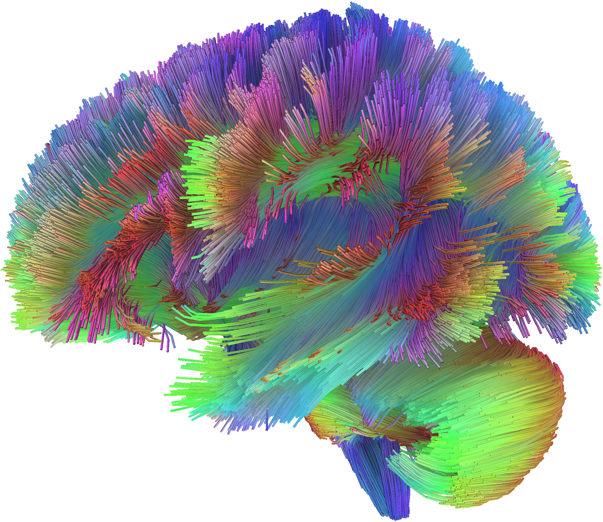 WhiteMatter：通过 KV 源混合实现的全对全跨层连接